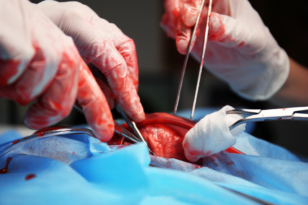 El apoyo de los jueces permitió realizar 1.728 trasplantes de órganos en 2023